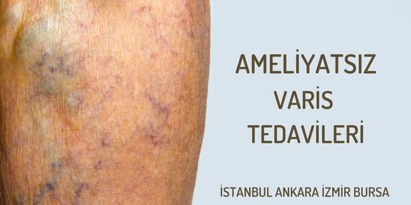 AMELİYATSIZ VARİS TEDAVİLERİ